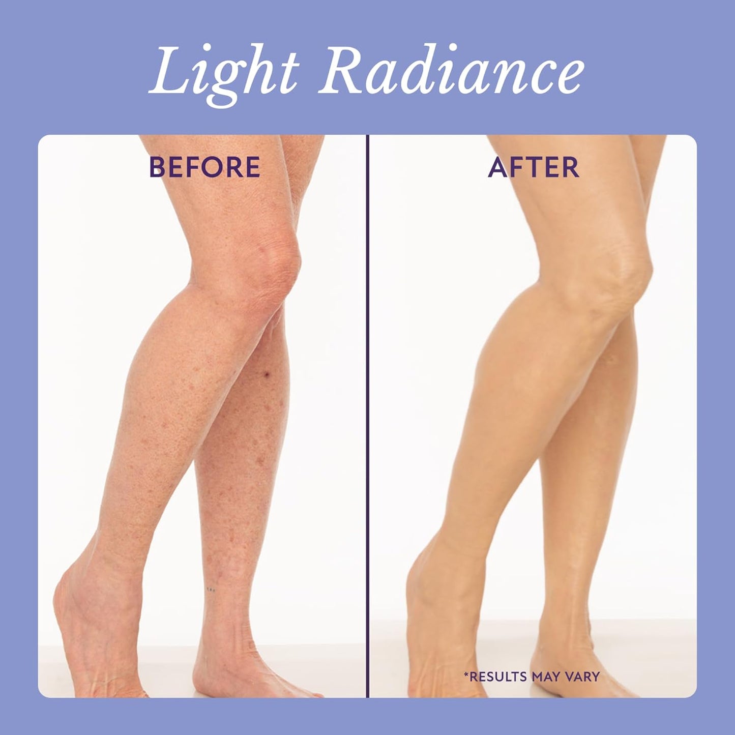 W® Body Coverage Perfector - Waterproof Leg & Body Concealer
